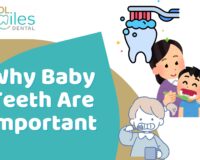 Why Baby Teeth Are Important: A Complete Guide for Parents