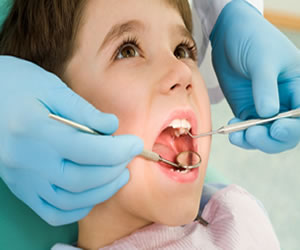 Pediatric Root Canal