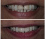 smile desgining best dental clinic in dombivli east